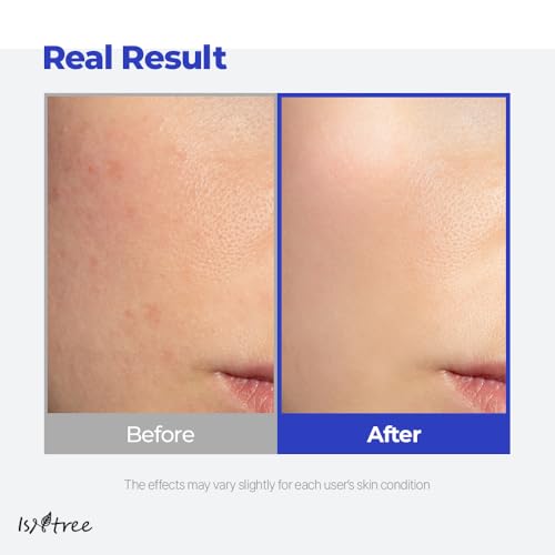 IsNtree Hyaluronic Acid Aqua Gel Cream 100ml, 3.38 fl oz | Korean Skincare | Lightweight Moisturizer | Quick-Absorbing Hydration | For Oily to Combination Skin - Image 4